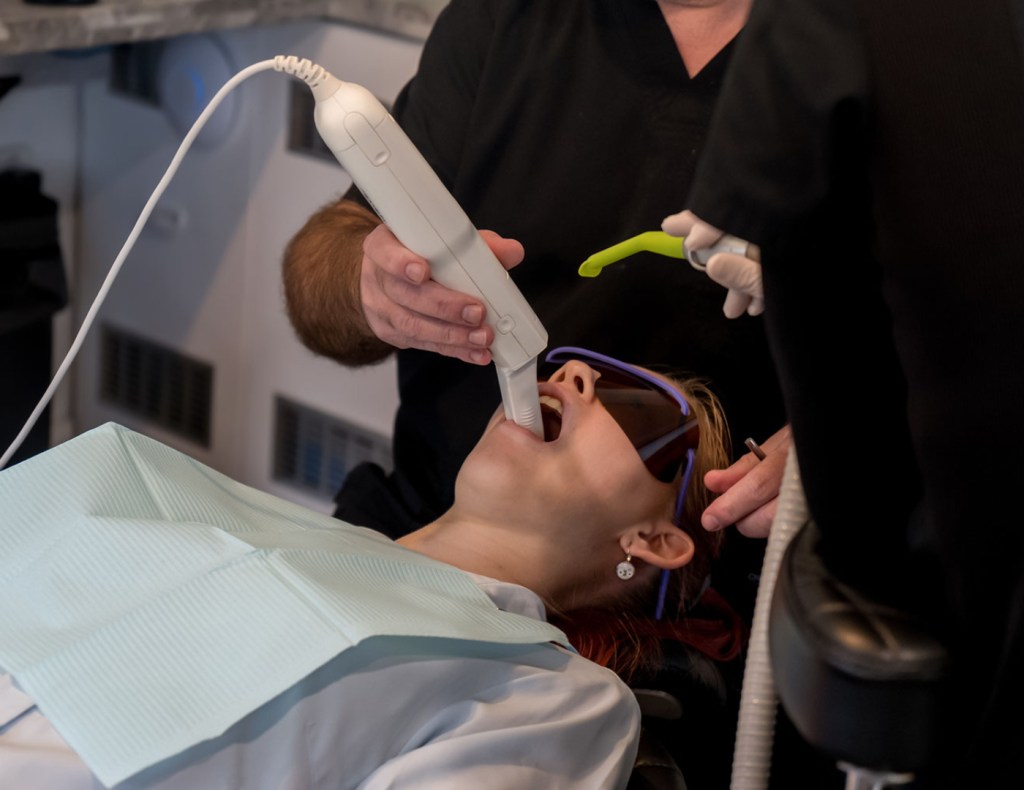 Escaneo digital para invisalign con escaner iTero elemrnt