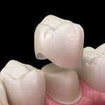 Rehabilitación Oral